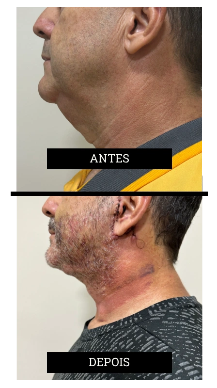 Novo Projeto (52)
