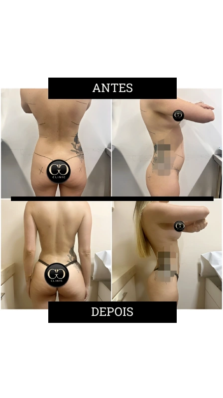Novo Projeto (54)